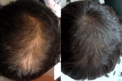 mesohair3-1024x682
