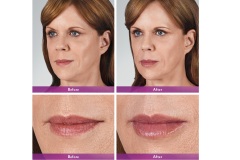 170520-Downloadable-BA_SHERILEE_ST4