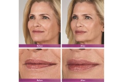 170522_Downloadable-B_A_TAMMY_ST3