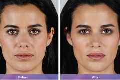 170191_Downloadable-B_A_KARLA_HR-3-1 170191_Downloadable-B_A_KARLA_HR-3-1